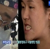 More natural, more Beautiful. The harmony of facial features! — Korea cost, reviews & before-after | MISOODA