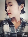 More natural, more Beautiful. The harmony of facial features! — Korea cost, reviews & before-after | MISOODA