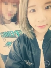 More natural, more Beautiful. The harmony of facial features! — Korea cost, reviews & before-after | MISOODA