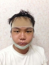 Although he sacrificed himself for his sister's sake, eventually he was rewarded with a brand new face in return! — Korea cost, reviews & before-after | MISOODA