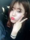 Ni (ptosis) + epi + lat — Korea cost, reviews & before-after | MISOODA