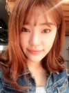 Ni (ptosis) + epi + lat — Korea cost, reviews & before-after | MISOODA