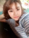 Ni (ptosis) + epi + lat — Korea cost, reviews & before-after | MISOODA