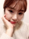 Ni (ptosis) + epi + lat — Korea cost, reviews & before-after | MISOODA