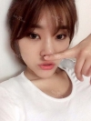 Ni (ptosis) + epi + lat — Korea cost, reviews & before-after | MISOODA