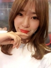 Ni (ptosis) + epi + lat — Korea cost, reviews & before-after | MISOODA