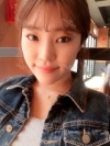 Ni (ptosis) + epi + lat — Korea cost, reviews & before-after | MISOODA