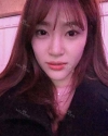 Ni (ptosis) + epi + lat — Korea cost, reviews & before-after | MISOODA