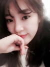 Ni (ptosis) + epi + lat — Korea cost, reviews & before-after | MISOODA