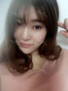 Ni (ptosis) + epi + lat — Korea cost, reviews & before-after | MISOODA