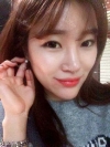Ni (ptosis) + epi + lat — Korea cost, reviews & before-after | MISOODA