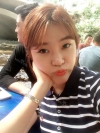 Ni (ptosis) + epi + lat — Korea cost, reviews & before-after | MISOODA