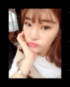 Ni (ptosis) + epi + lat — Korea cost, reviews & before-after | MISOODA
