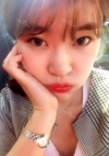 Ni (ptosis) + epi + lat — Korea cost, reviews & before-after | MISOODA