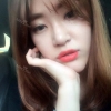 Ni (ptosis) + epi + lat — Korea cost, reviews & before-after | MISOODA