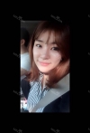 Ni (ptosis) + epi + lat — Korea cost, reviews & before-after | MISOODA