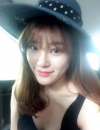 Ni (ptosis) + epi + lat — Korea cost, reviews & before-after | MISOODA