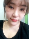 Ni (ptosis) + epi + lat — Korea cost, reviews & before-after | MISOODA