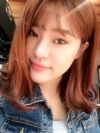 Ni (ptosis) + epi + lat — Korea cost, reviews & before-after | MISOODA