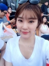 Ni (ptosis) + epi + lat — Korea cost, reviews & before-after | MISOODA