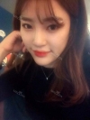 Ni (ptosis) + epi + lat — Korea cost, reviews & before-after | MISOODA
