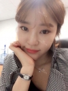 Ni (ptosis) + epi + lat — Korea cost, reviews & before-after | MISOODA