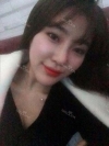 Ni (ptosis) + epi + lat — Korea cost, reviews & before-after | MISOODA