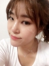 Ni (ptosis) + epi + lat — Korea cost, reviews & before-after | MISOODA