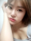 Ni (ptosis) + epi + lat — Korea cost, reviews & before-after | MISOODA