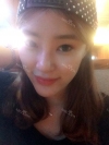 Ni (ptosis) + epi + lat — Korea cost, reviews & before-after | MISOODA