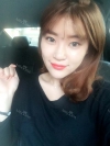 Ni (ptosis) + epi + lat — Korea cost, reviews & before-after | MISOODA