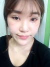 Ni (ptosis) + epi + lat — Korea cost, reviews & before-after | MISOODA