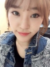 Ni (ptosis) + epi + lat — Korea cost, reviews & before-after | MISOODA
