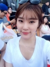 Ni (ptosis) + epi + lat — Korea cost, reviews & before-after | MISOODA
