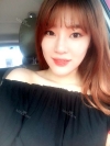 Ni (ptosis) + epi + lat — Korea cost, reviews & before-after | MISOODA