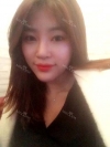 Ni (ptosis) + epi + lat — Korea cost, reviews & before-after | MISOODA