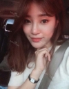 Ni (ptosis) + epi + lat — Korea cost, reviews & before-after | MISOODA