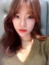 Ni (ptosis) + epi + lat — Korea cost, reviews & before-after | MISOODA