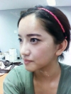 She was suffering from crooked face! — Korea cost, reviews & before-after | MISOODA