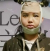 She was suffering from crooked face! — Korea cost, reviews & before-after | MISOODA