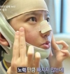 She was suffering from crooked face! — Korea cost, reviews & before-after | MISOODA