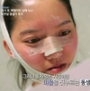 She was suffering from crooked face! — Korea cost, reviews & before-after | MISOODA