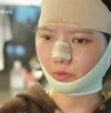 She was suffering from crooked face! — Korea cost, reviews & before-after | MISOODA