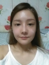 Reviews, Cheekbone, Square jaw at View plastic surgery clinic — Korea cost, reviews & before-after | MISOODA