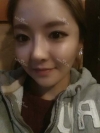 Reviews, Cheekbone, Square jaw at View plastic surgery clinic — Korea cost, reviews & before-after | MISOODA