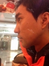 I want to be more gentle visually... — Korea cost, reviews & before-after | MISOODA