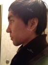 I want to be more gentle visually... — Korea cost, reviews & before-after | MISOODA