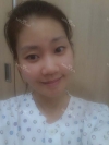 It was my dream to have a perfect face... — Korea cost, reviews & before-after | MISOODA