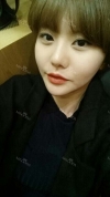 Cheekbone Reduction+ Mini V-line+ T.O.P Rrhinoplasty — Korea cost, reviews & before-after | MISOODA