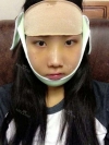 I had eager for a nice face since I was a little girl. — Korea cost, reviews & before-after | MISOODA